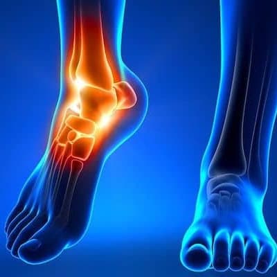 fit feet podiatrists larne northern ireland biomechanical evaluation 400