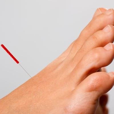 podiatry acupunture fit feet podiatrists larne northern ireland