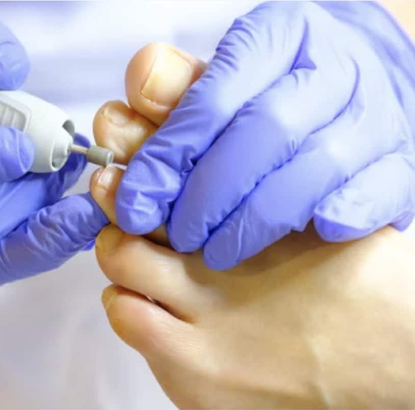 standard podiatry treatment fit feet podiatrists larne northern ireland