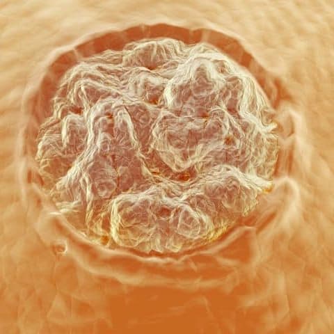 verruca treatment fit feet podiatrists larne northern ireland